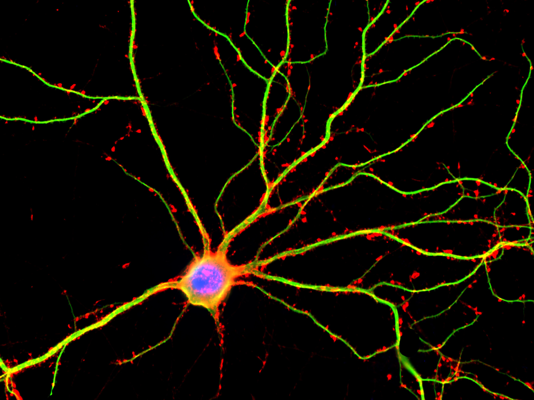 Study reveals how neurons differentiate between motor and sensory signals￼￼